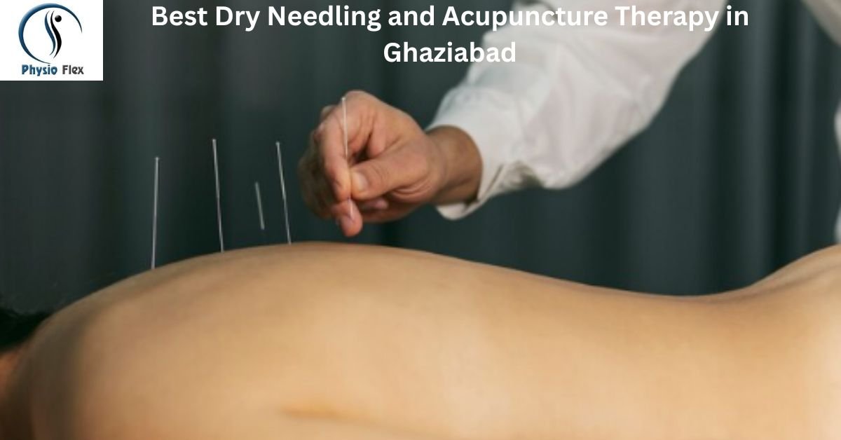 Best Dry Needling and Acupuncture Therapy in Ghaziabad